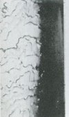 18: Caucasoid Human head-hair (X550).